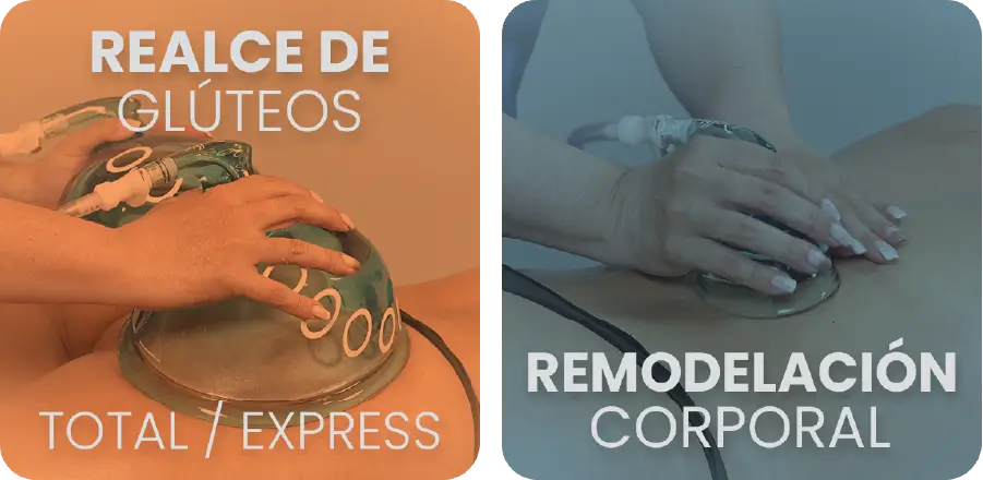 Tratamientos 1 ES (2)