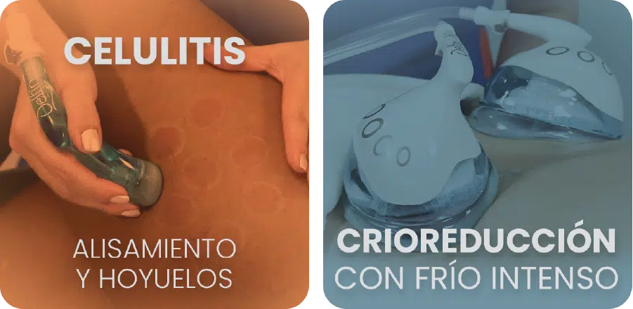 Tratamientos 2 ES (1)