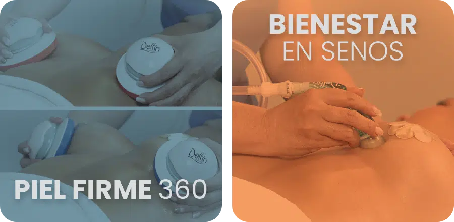 Tratamientos 4 ES (1)