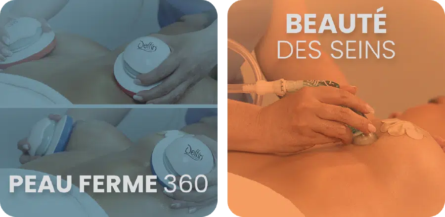 Tratamientos 4 FR