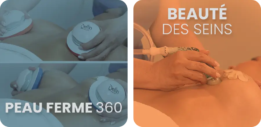 Tratamientos 4 FR