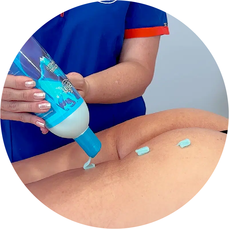 Gel criogenico