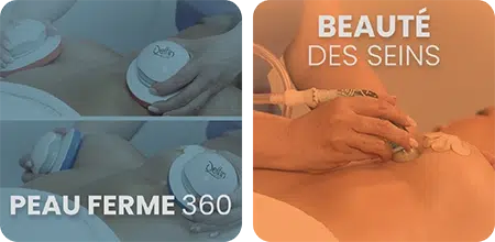 Tratamientos 4 FR